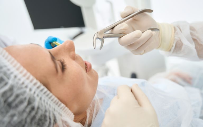 Dentist performing tooth extraction procedure in Huntington Beach