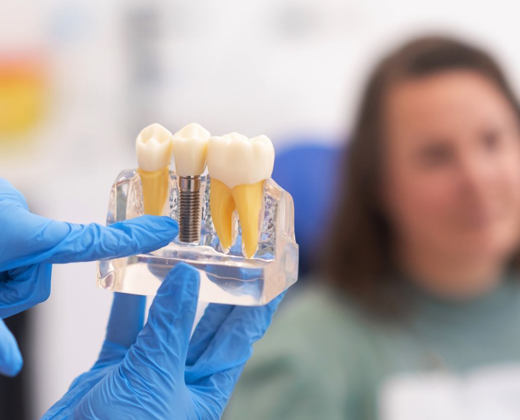 dental implant procedure in huntington beach, ca