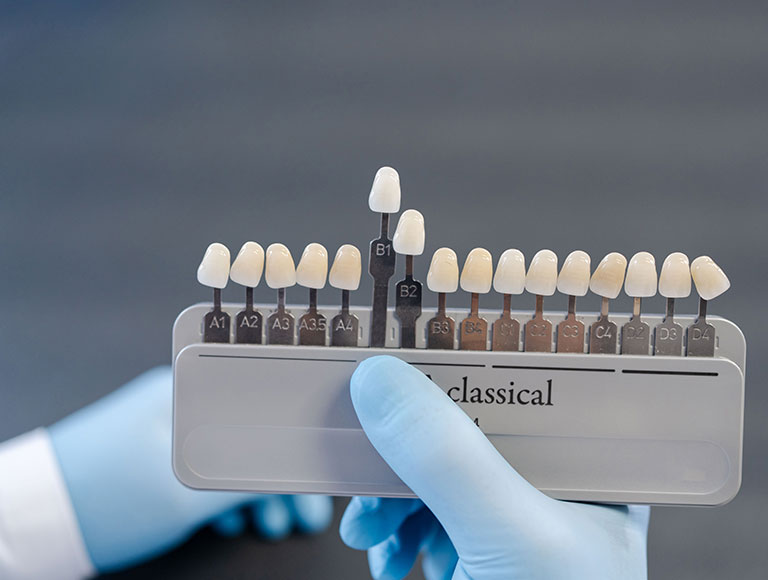 porcelain veneers in huntington beach, ca