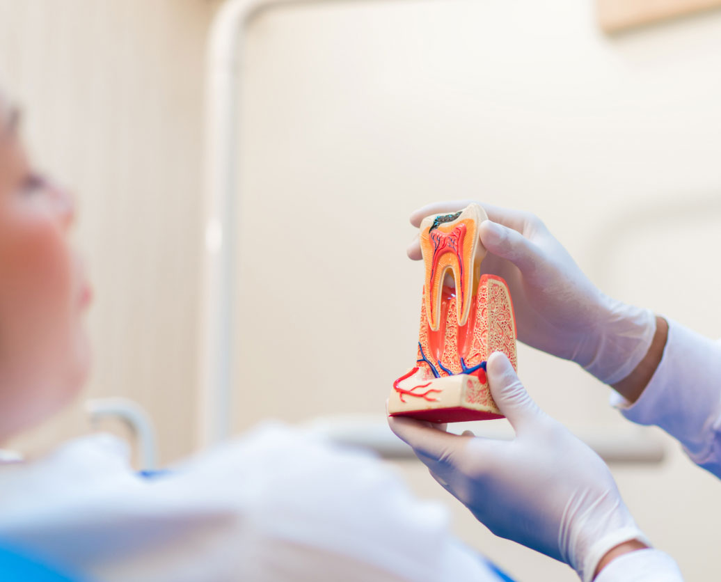 root canal therapy in huntington beach, ca